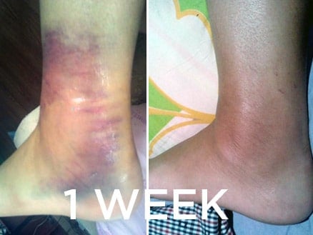 Results in the first week — Erikka Fernando