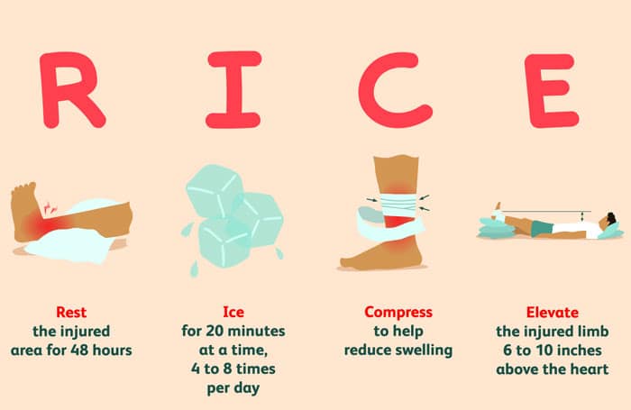 RICE - Rest, Ice, Compression, Elevation