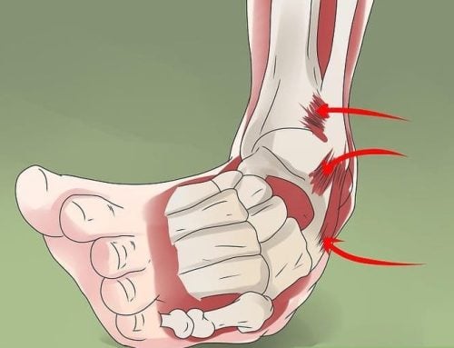 Do ankle sprains ever fully heal?