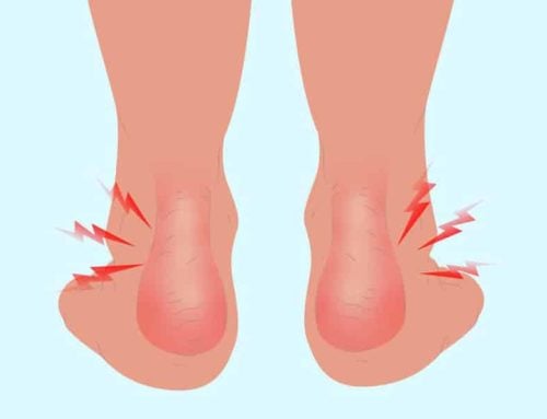Sore Ankles: Why Does My Ankle Hurt?
